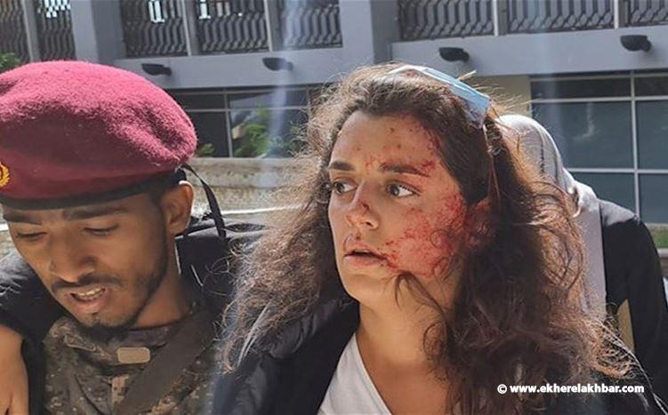 لبنانية تنجو بأعجوبة من تفجير مطار عدن